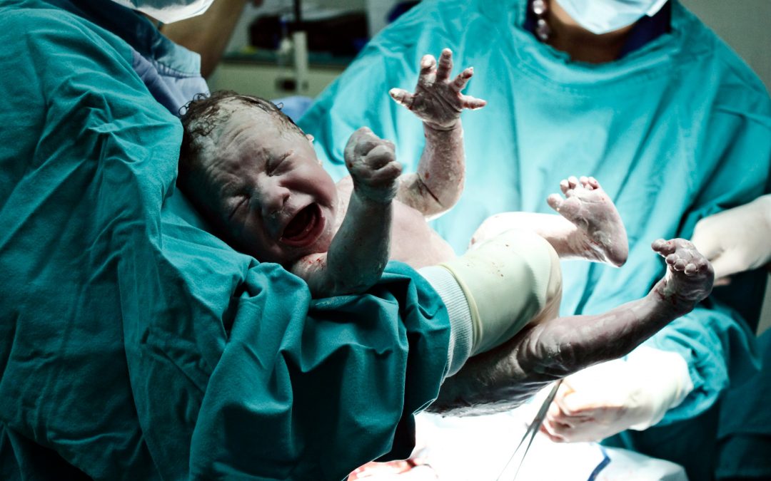 What you need to know about Caesarean sections (C-sections)