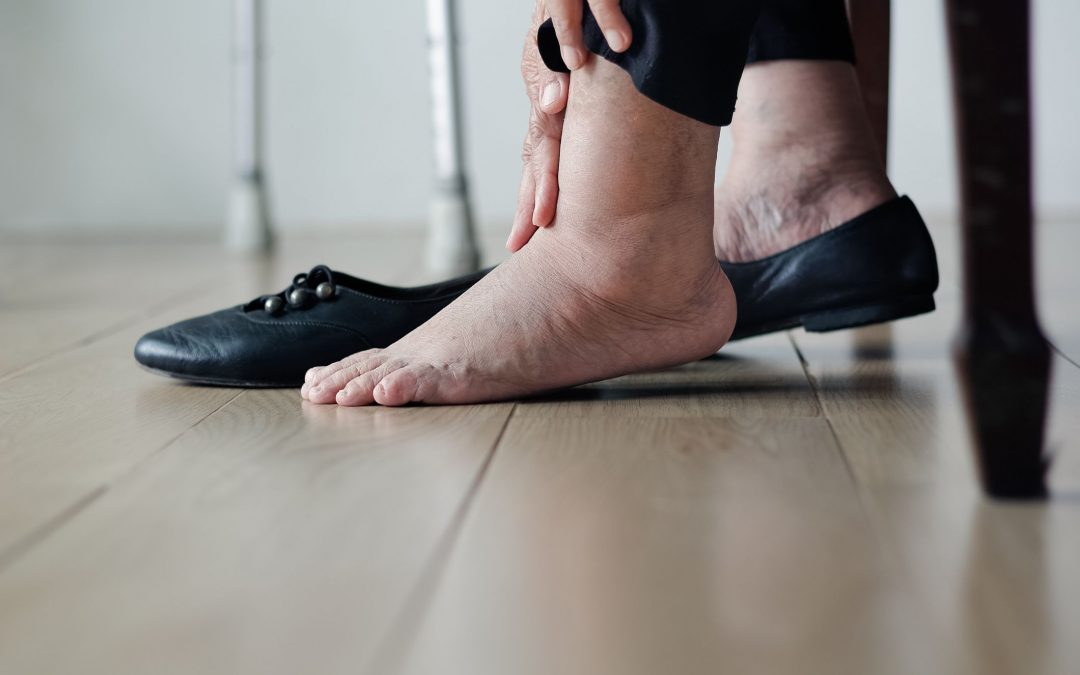 When do swollen ankles and feet signify a heart valve problem?