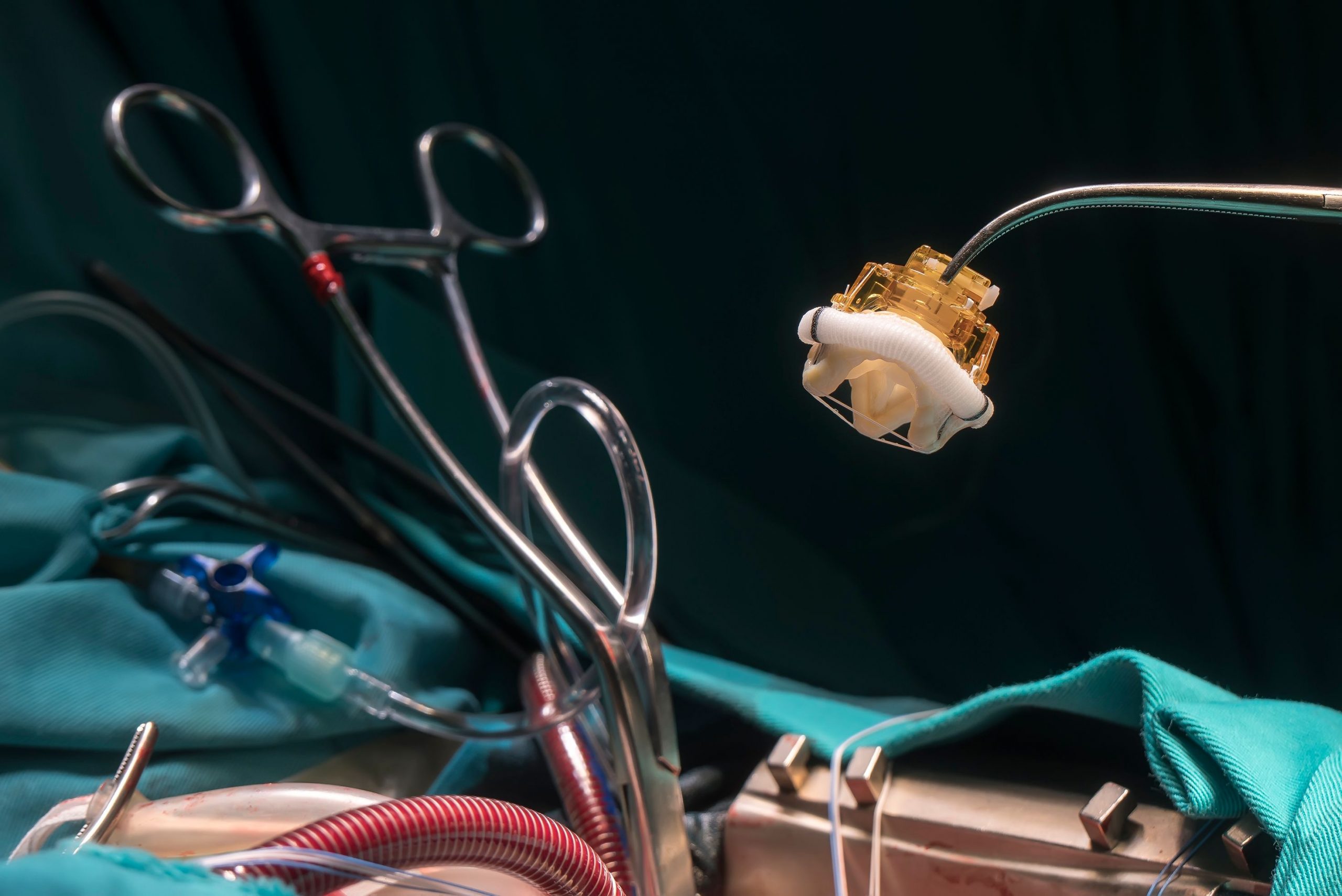 How should mitral valve abnormalities be treated?