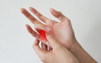 Trigger finger – causes, symptoms, treatment