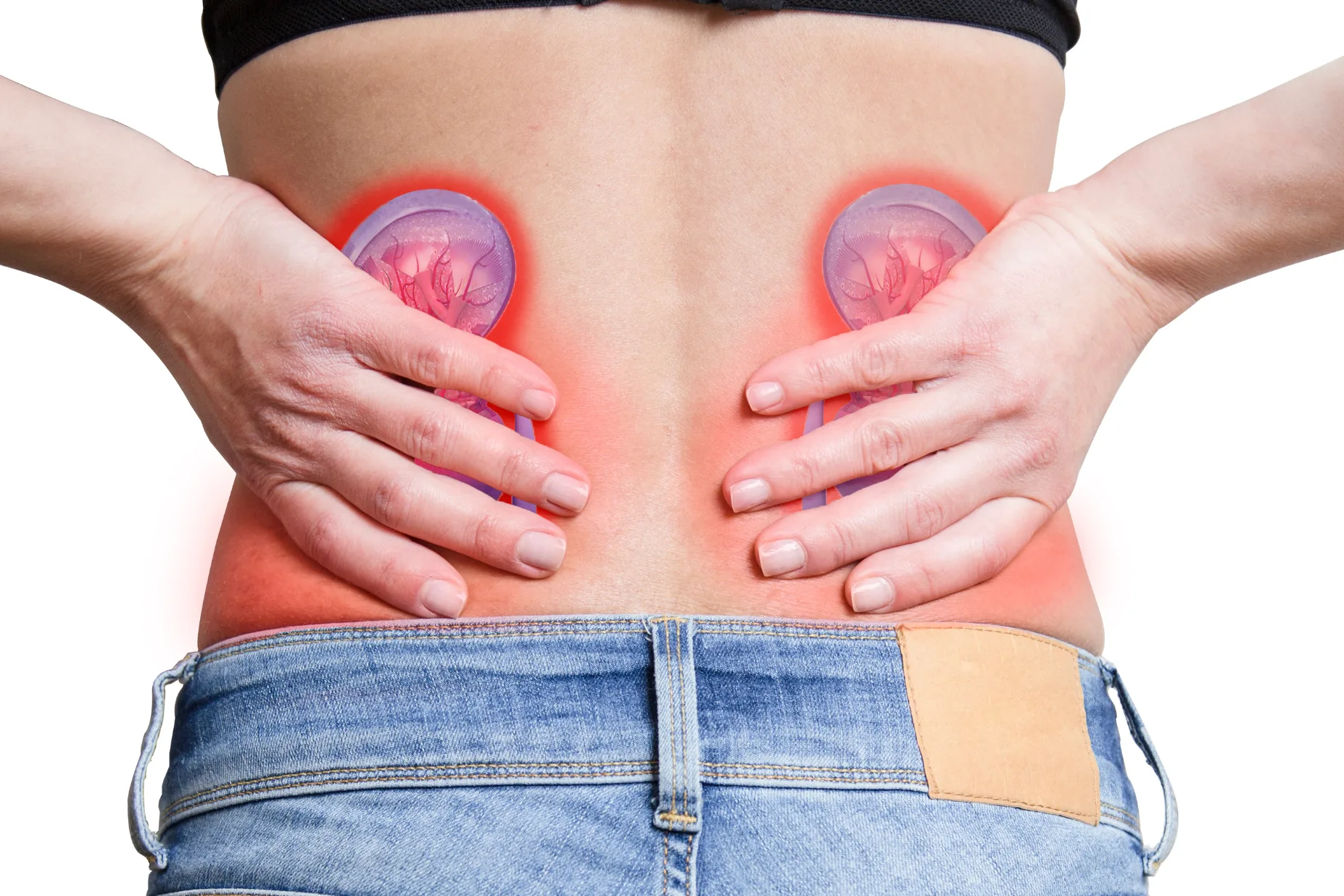 Asia MD_Kidney Stones