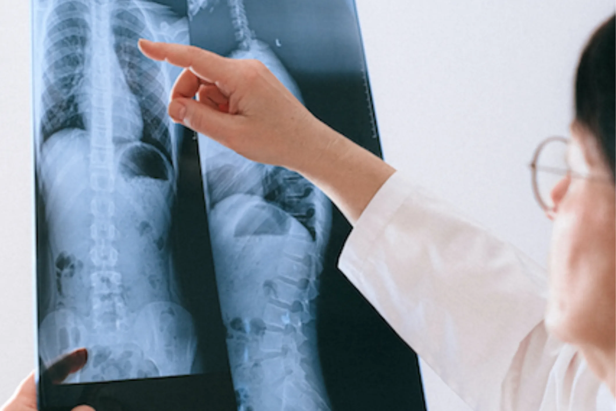 Asia MD What are the earliest signs of heart failure?