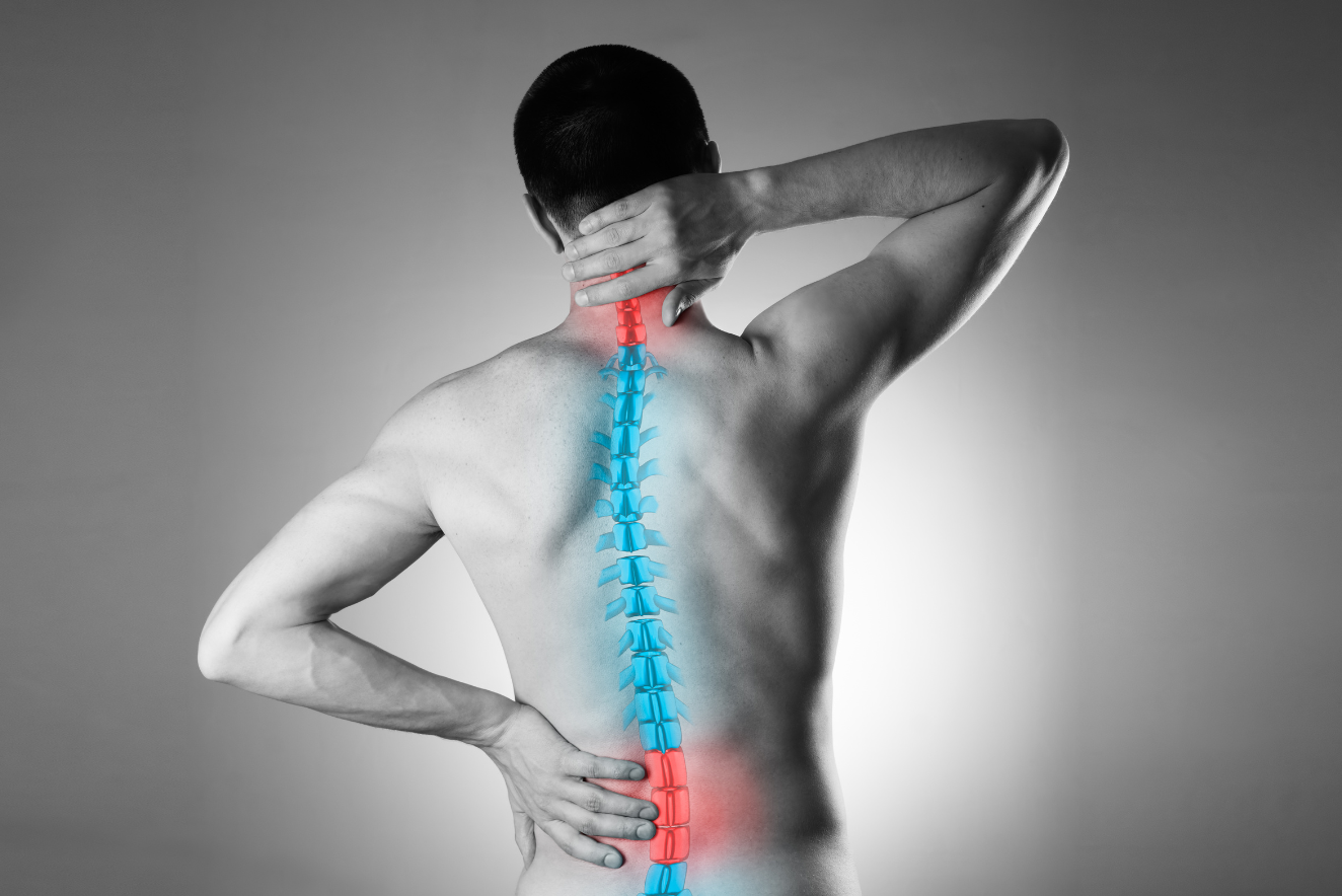 Treatment of spinal deformities