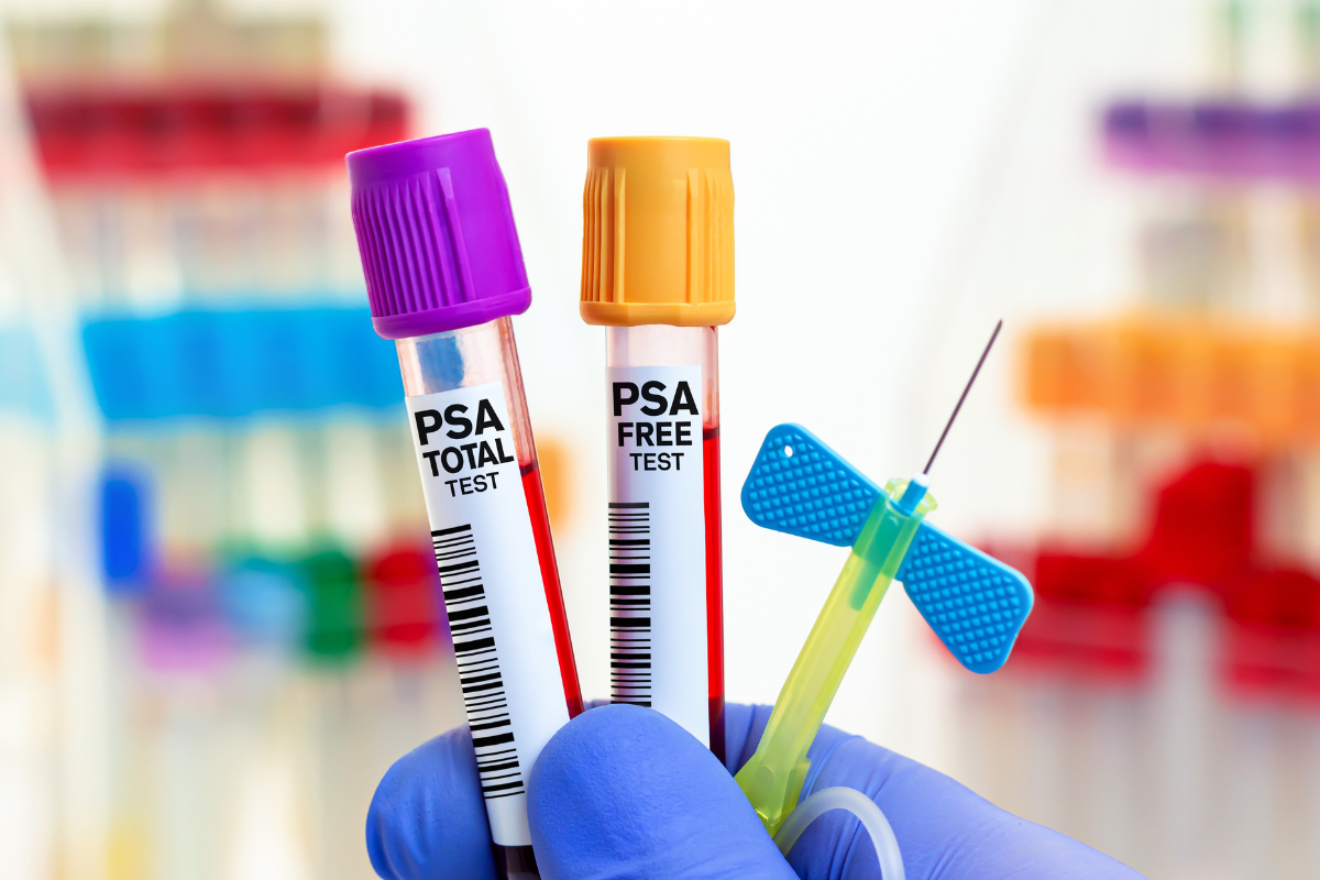 Asia MD_The PSA Debate Should You Get Tested
