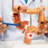 Asia MD_News_The Silent Revolution in Colorectal Cancer Care 1