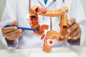 Asia MD_News_The Silent Revolution in Colorectal Cancer Care 1