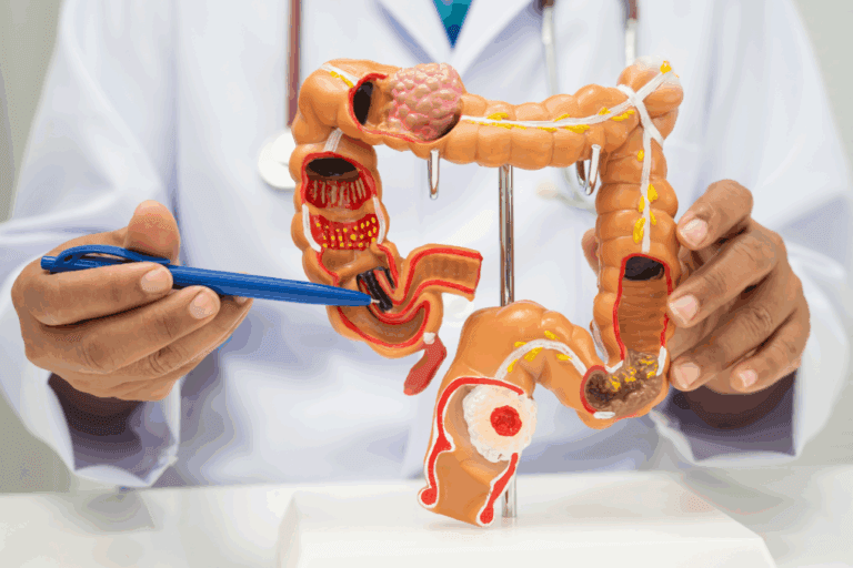 Asia MD_News_The Silent Revolution in Colorectal Cancer Care 1