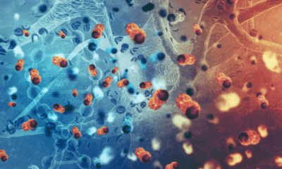 Asia MD_Quantum-AI Platform for Cancer Immunotherapy (Japan)